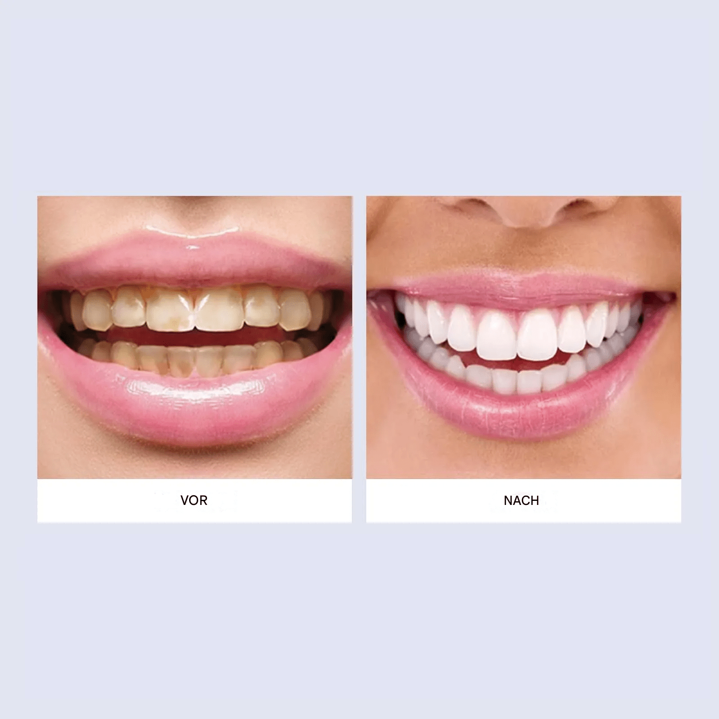 Hydroxyapatite Toothpaste